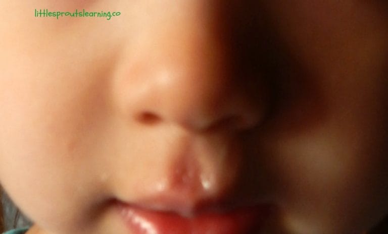 When your child is sick, you still have responsibilities, and you need to be at work. But why does the daycare have such a strict daycare sick policy?